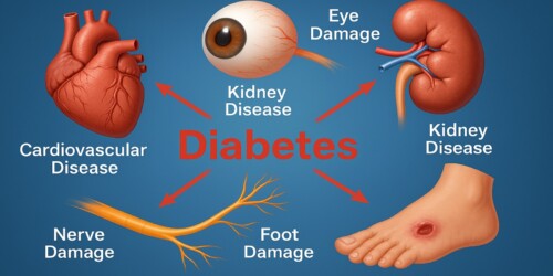 Biến chứng tiểu đường: tim, thận, mắt, dây thần kinh.