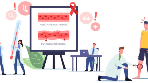 Minh họa mạch máu, viêm và khám chân.