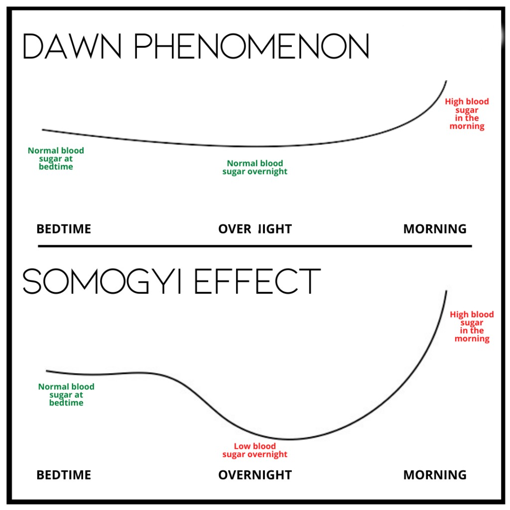 Khác nhau giữa Hiện tượng Bình minh ( Dawn Phenomenon )và hiệu ứng Somogyi ( Somogyi Effect)