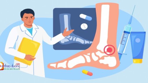 Chẩn đoán và điều trị biến chứng thần kinh ngoại biên do đái tháo đường