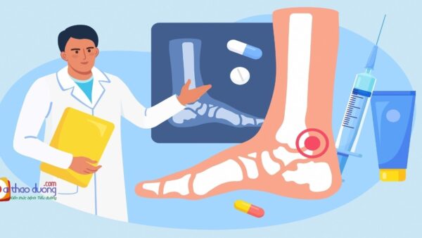 Chẩn đoán và điều trị biến chứng thần kinh ngoại biên do đái tháo đường