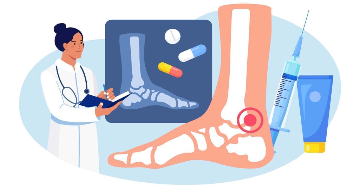 Guideline IWGDF hướng dẫn chăm sóc bàn chân tiểu đường