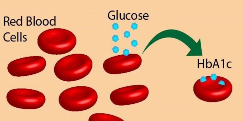 HbA1c được hình thành từ Glucose và Hemoglobine
