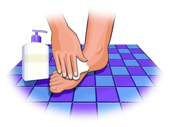 Chăm sóc bàn chân tiểu đường: Tránh để khô da