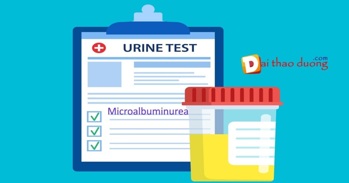 Xét nghiệm tìm vi đạm niệu giúp phát hiện sớm bệnh thận tiểu đường