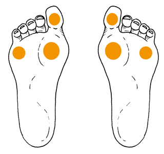 Các vị trí đặt monofilament trên bàn chân