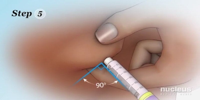 Hướng dẫn sử dụng bút tiêm insulin: Đâm thẳng góc với da