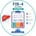Tính điểm FIB-4 để tầm soát bệnh gan nhiễm mỡ do chuyển hóa