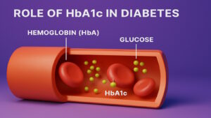HbA1c là gì? Vai trò HbA1c trong chẩn đoán, theo dõi điều trị bệnh tiểu đường