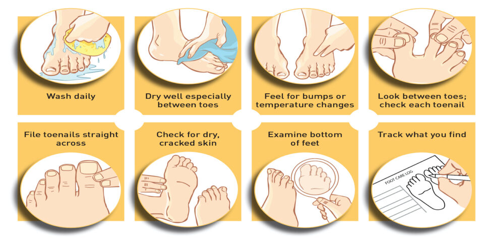 Kiểm tra bàn chân mỗi ngày để phát hiện biến chứng thần kinh do tiểu đường